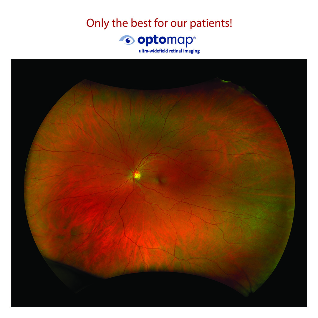 Only the best for our patients! Optomap ultra-widefield retinal imaging